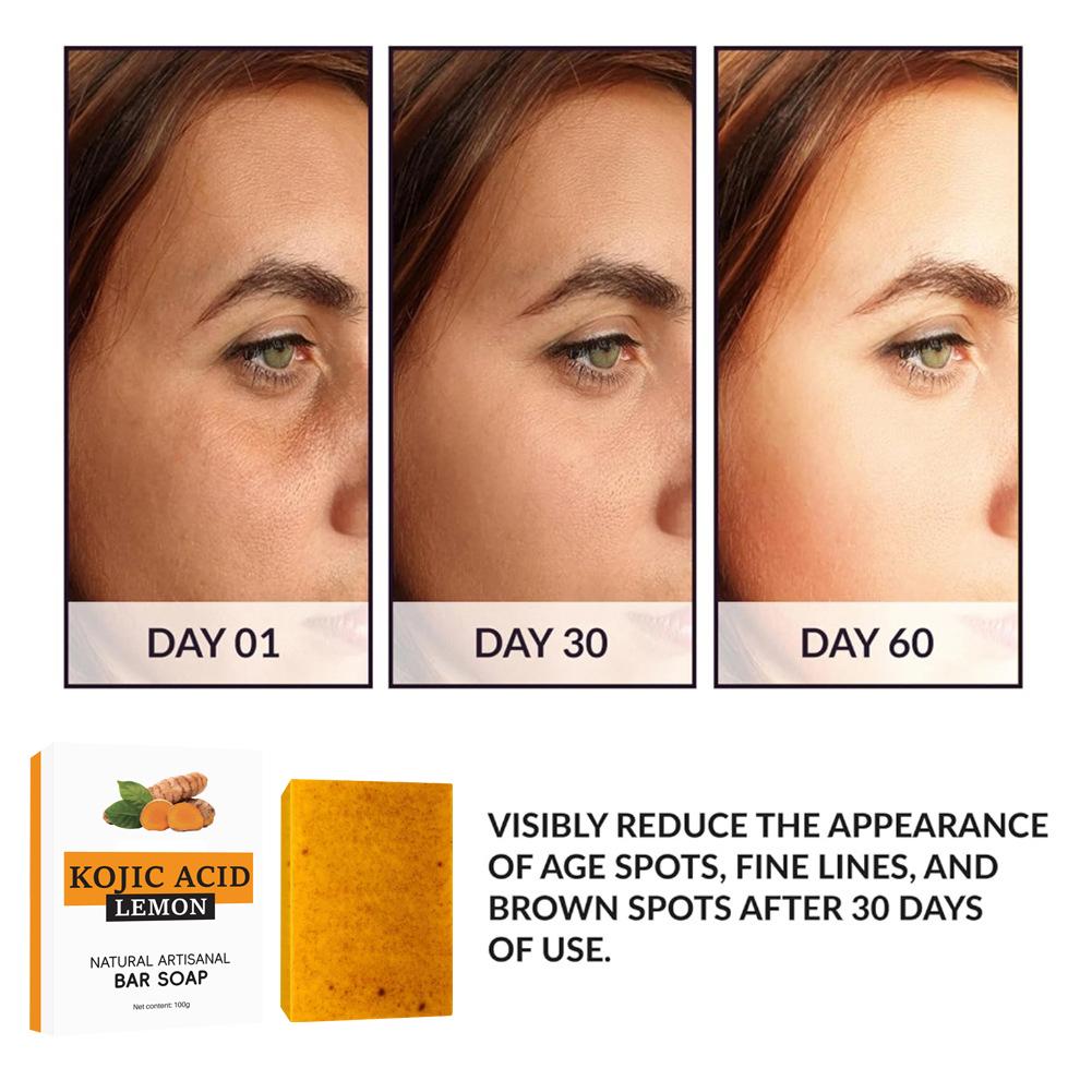 Newly upgrade Turmeric Kojic A - Kojic Acid Soap บทวิจารณ์และราคา