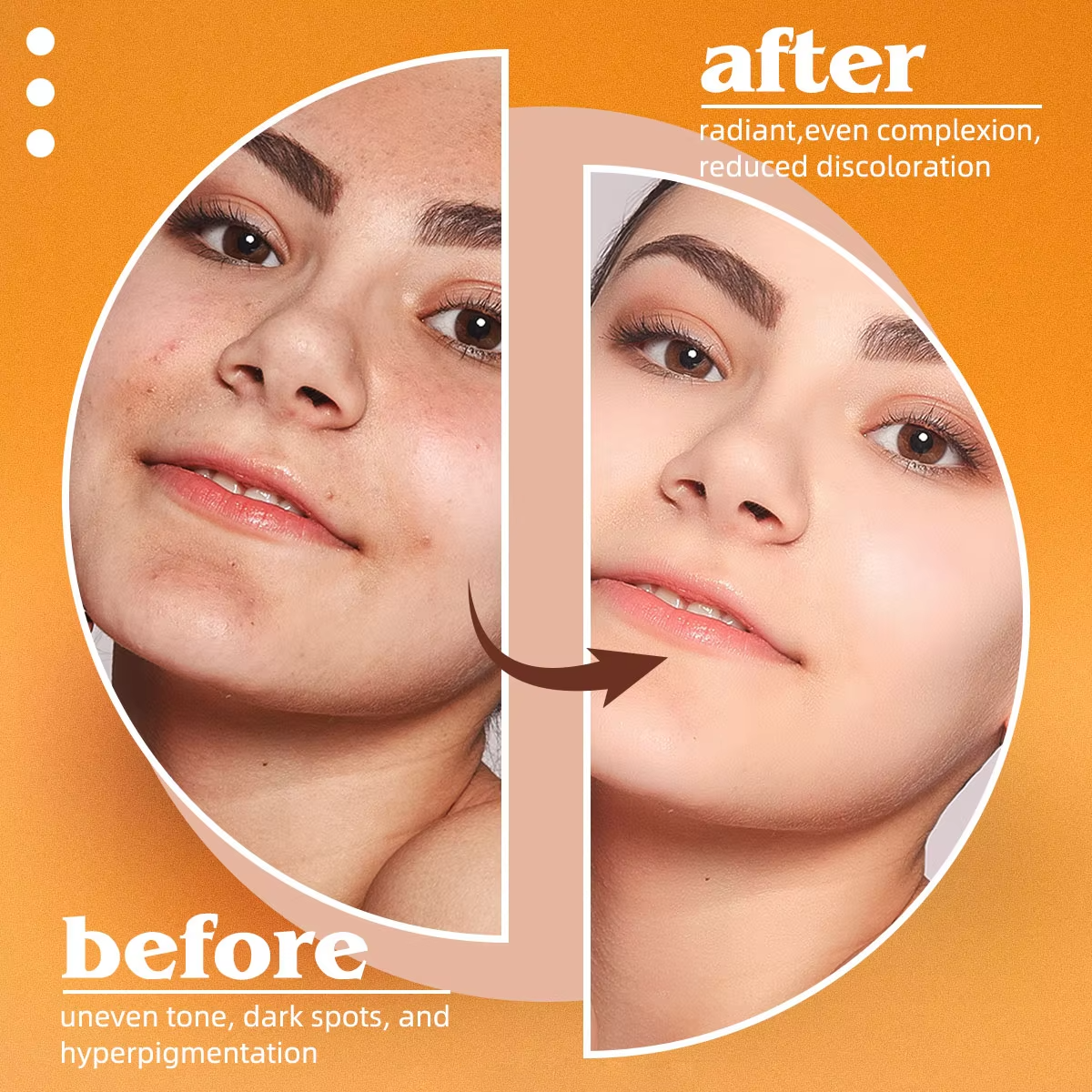 Kojic Acid Natural Papaya Soap - Kojic Acid Soap บทวิจารณ์และราคา