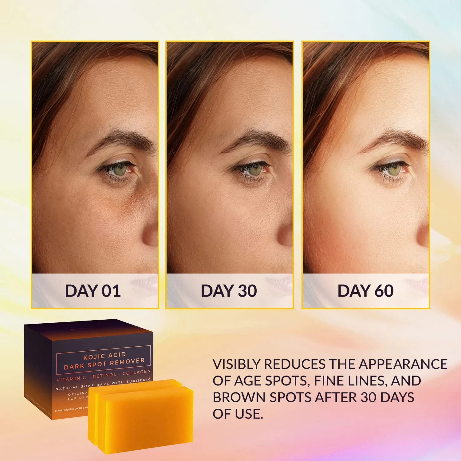 Kojic Acid Dark Spot Remover W - Kojic Acid Soap บทวิจารณ์และราคา